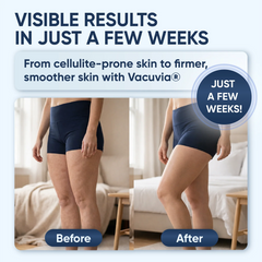 Vacuvia Sculpt Glow -Firmer, More Toned Skin